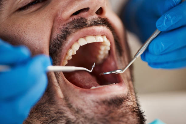 Best Emergency Dentist for Lost Fillings or Crowns in Aristocrat Ranchettes, CO